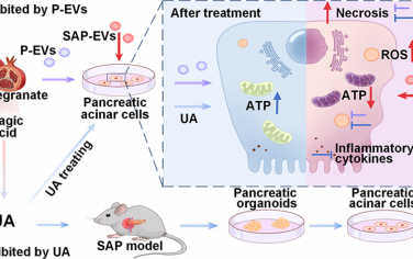 ACS Nano：尿石素A可通过调节内质网-线粒体钙通道缓解重症急性胰腺炎