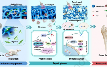 Biomaterials：超声触发的功能水凝胶用于促进多阶段骨再生