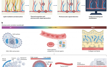 Nature Reviews Bioengineering：光声成像的临床转化