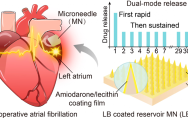ACS Nano：微针贴片用于预防术后心房颤动