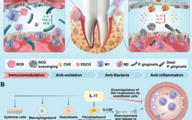 Adv. Mater：具有抗菌和活性氧清除特性的免疫调节水凝胶用于治疗糖尿病牙周炎