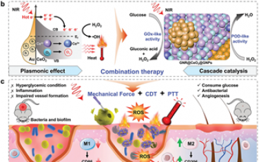 Adv. Mater：基于等离激元超分子纳米酶的生物苍耳用于协同治疗糖尿病感染创面