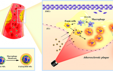 Anal. Chem：巨噬细胞膜工程化的纳米探针用于对动脉粥样硬化斑块中的铁死亡进行可视化成像