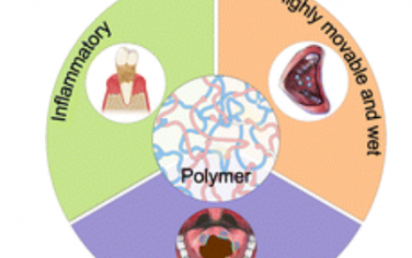 Chem. Soc. Rev.：用于治疗口腔疾病的新兴聚合物材料