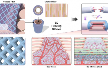 Nano Lett：协同型生物滤管用于促进无瘢痕肌腱再生