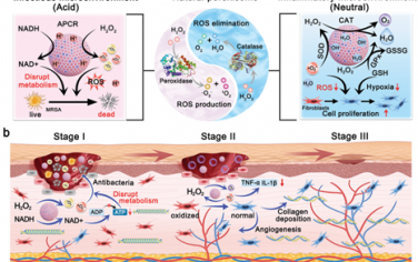 Adv. Mater：具有Co-Ru配对中心、可自适应感染和炎症微环境的人工过氧化物酶体用于治疗糖尿病溃疡