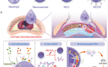 Adv. Mater：工程化中性粒细胞纳米囊泡可通过抗炎、抗VEGF和化学激发的光动力疗法协同抑制角膜新生血管