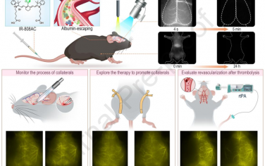 Biomaterials：新型的NIR-II白蛋白逃逸探针用于对卒中小鼠模型进行脑动脉和灌注成像