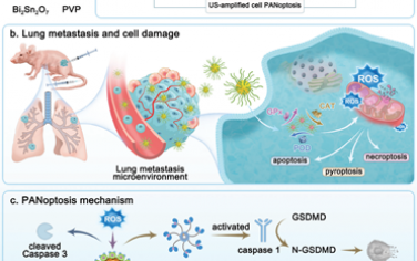 Adv. Mater：超小酶动力学泛凋亡纳米诱导剂用于超声增强的肝细胞癌治疗和肺转移抑制