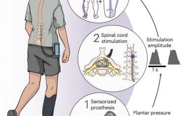 Nature BME：让截肢患者恢复走路