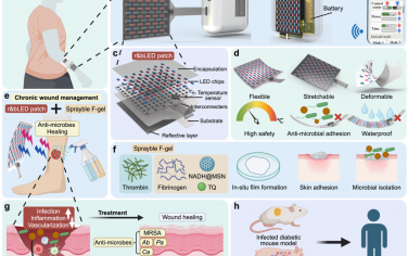Nat. Commun：可穿戴、可拉伸的双波长LED装置用于慢性感染伤口的家庭护理