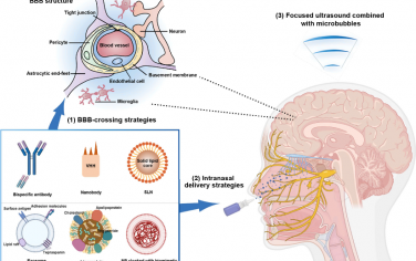 ACS Nano综述：用于无创脑递送治疗性蛋白质和多肽的先进策略