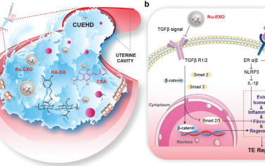 Adv. Mater：携带植物雌激素和尿外泌体的多巴胺修饰透明质酸基黏液用于修复薄型子宫内膜