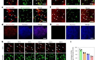 Nature Nanotechnology：有机和无机纳米颗粒在脑内的命运取决于小胶质细胞胞外囊泡的功能