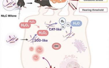 AFM：2D催化碳化铌MX酶改善噪声性听力损失