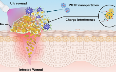 Nano Lett：超声驱动的电荷干扰疗法用于治疗伤口感染