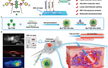 Adv. Mater：基于NIR-II AIE发光素的间质光纤介导的原位乳腺癌多模态光学诊疗