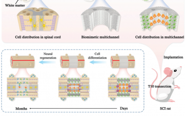 Adv. Mater：具有多细胞时空分布的仿生多通道丝神经导管用于脊髓损伤修复
