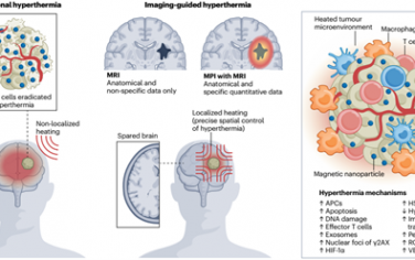 Nat. Rev. Bioeng：利用磁性纳米颗粒实现成像引导的精准热疗