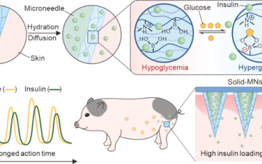 ACS Nano：可高效负载胰岛素的葡萄糖响应性微针贴片用于实现对小鼠和小型猪的长期血糖控制