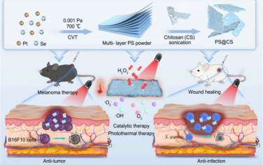 Nano Lett：NIR-II光驱动的多功能纳米酶用于治疗黑色素瘤和肿瘤手术后感染