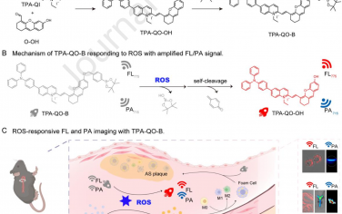 Biomaterials：响应活性氧(ROS)的荧光和光声(FL/PA)双模态探针用于动脉粥样硬化斑块成像