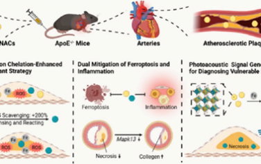 JACS：将动脉粥样硬化斑块的铁原位转化为纳米诊疗