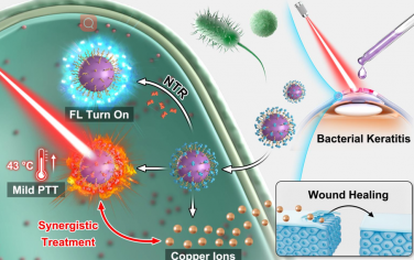Biomaterials：硝基还原酶响应性纳米颗粒用于对细菌性角膜炎进行原位荧光成像和协同抗菌治疗
