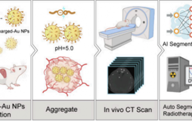 Nano Lett：带电金纳米粒子用于CT成像引导的小肝细胞癌自适应放疗的靶点识别-对齐和自动分割