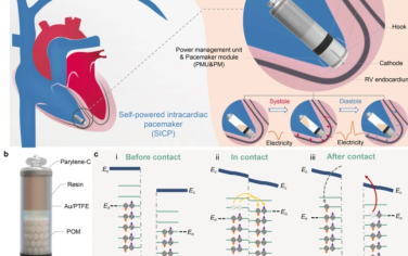 Nat. Commun.：猪模型心脏内自供电起搏器