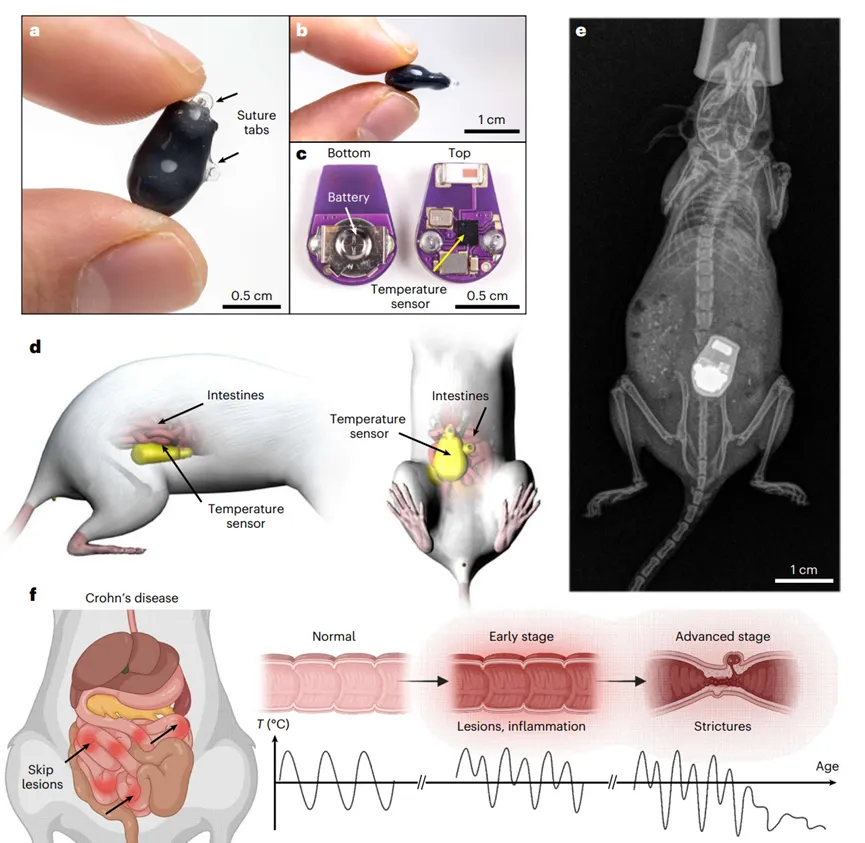 Nature Biomedical Engineering：植入式温度传感器