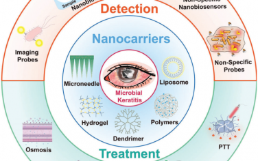 Adv. Mater综述：纳米医学用于检测和治疗眼部细菌感染