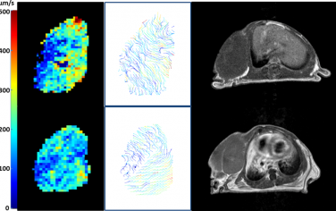 Anal. Chem：通过基于MRI的组织间流体速度分析评价肿瘤中的药物递送效率