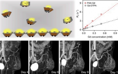 ACS Nano：利用联锁造影剂对肿瘤血管进行高分辨率磁共振血管造影