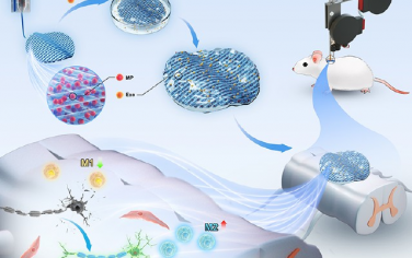 ACS Nano：雪旺细胞源性外泌体和甲泼尼龙复合贴片用于脊髓损伤修复