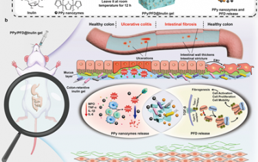 Nat. Commun：可在肠道长期保留的三元菊粉水凝胶可同时逆转IBD及其纤维化并发症