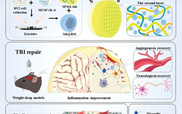 AFM：一种新型3D打印双层颅骨脑补片促进脑损伤修复和骨组织再生