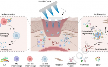 Biomaterials：生物活性硫糖铝基微针可通过重编程巨噬细胞和保护内源性生长因子促进伤口愈合