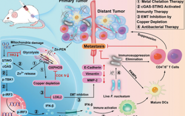 Angew：金属螯合疗法可通过铜耗竭和锌离子激增有效消除乳腺癌和瘤内细菌并抑制肿瘤转移