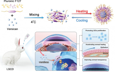 AFM：增强型滴眼液通过持续释放Versican和提供润滑基质来刺激角膜再生